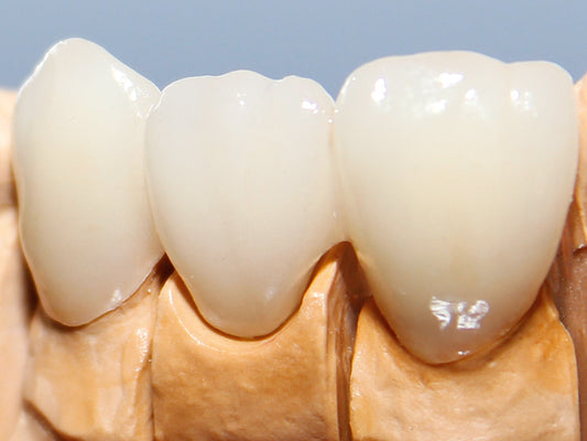 K2 Li Dentin YETI DENTAL