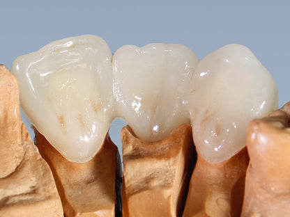 k2 Li CL 20grs -Clear Yeti Dental-